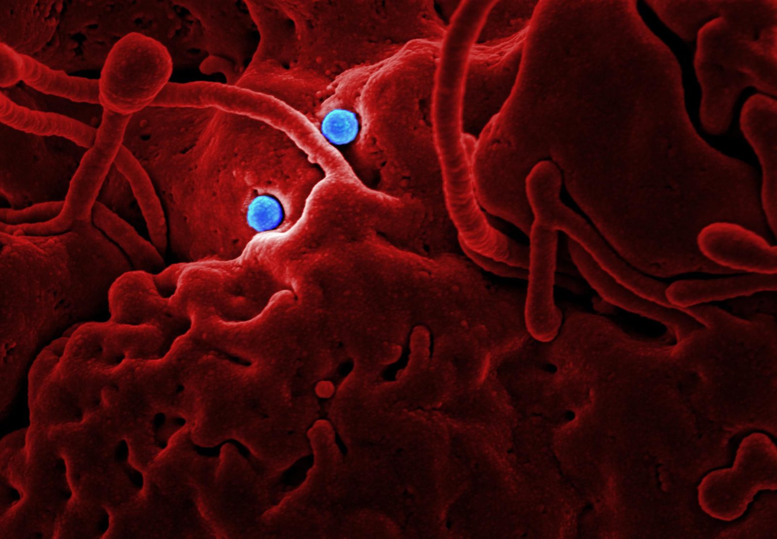 Disabling NFIL3 helped engineered immune cells resist "exhaustion" in animal tests.